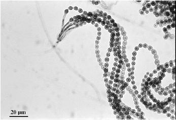 Penicilium sp. Ochratoxiny u zvířat výrazné podráždění sliznice trávicího ústrojí + rozvojakutní gastroenteritidy.