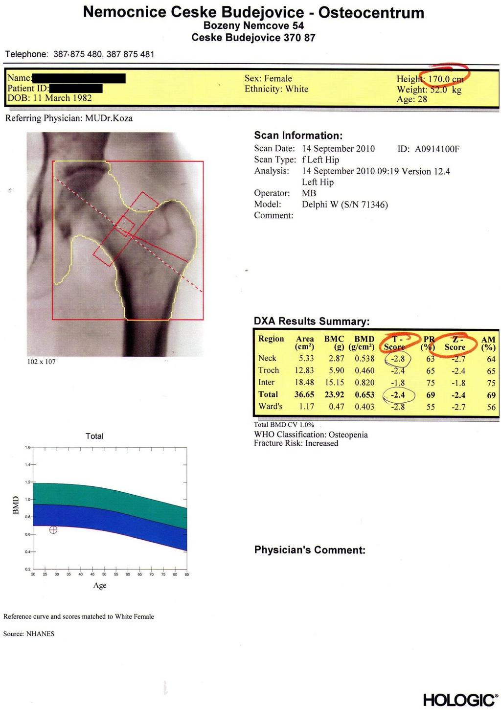 Kostní denzitometrie - PDF Stažení zdarma