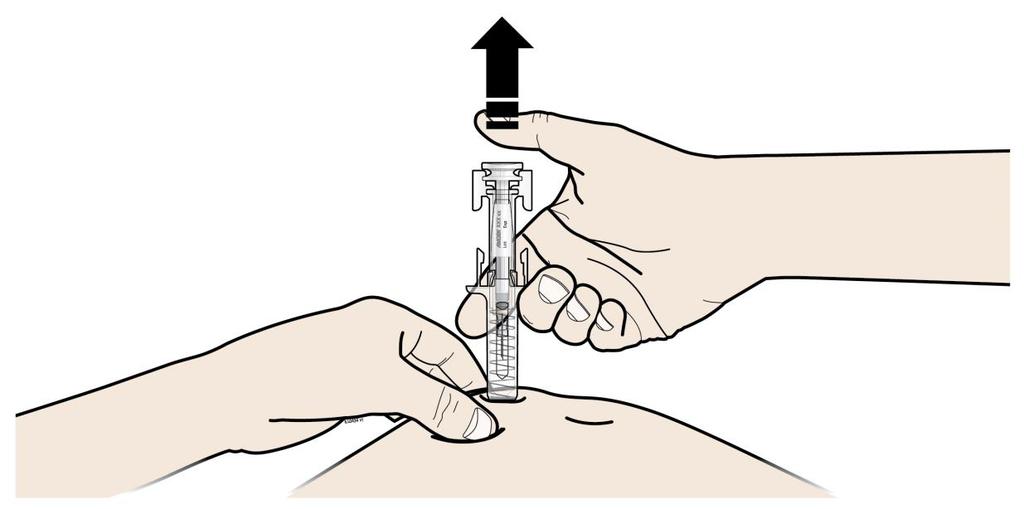 CVAK Je důležité stlačit píst zcela dolů až do cvaknutí, aby byla podána celá Vaše dávka. C UVOLNĚTE palec.