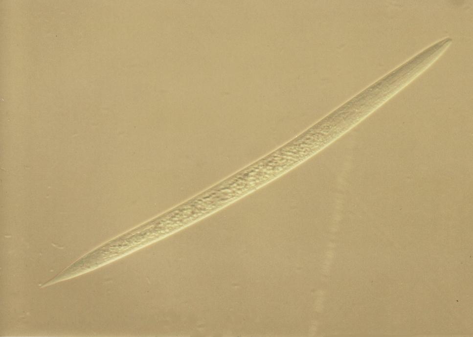 Paraziti přežvýkavců Dictyocaulus viviparus Larva L1: 400 25 µm, 2/3 těla jsou vyplněny množstvím zásobních tukových a bílkovinných granulí, které zcela zakrývají zažívací soustavu Dospělec: samec 35