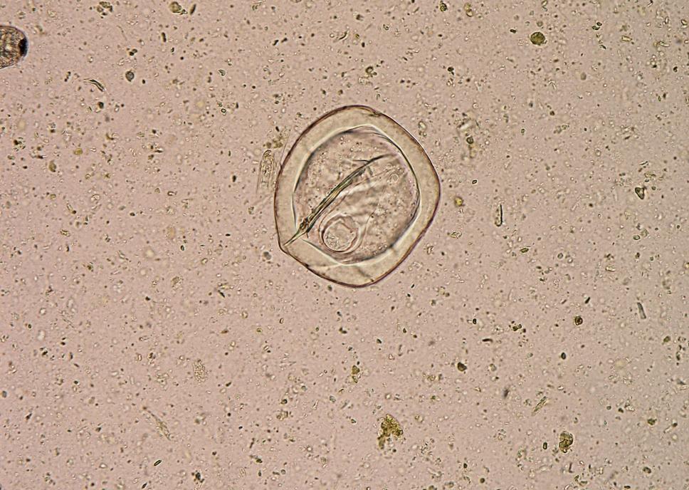 Paraziti koní Anoplocephala perfoliata Vajíčka: 60 80 μm, oválná až polygonální, s pyriformním aparátem obsahujícím 6 emryonálních háčků (hexakant) Dospělec: 3 8 cm dlouhý a 1,5 2 cm široký s