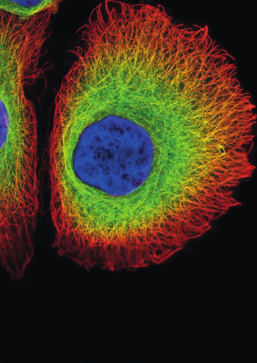 Podpora špičkového výzkumu Supporting Top Quality Research foto Zora Nováková, Biotechnologický ústav AV ČR, Věda fotogenická Z buňky kráskou: Posttranslační modifikace tubulinu