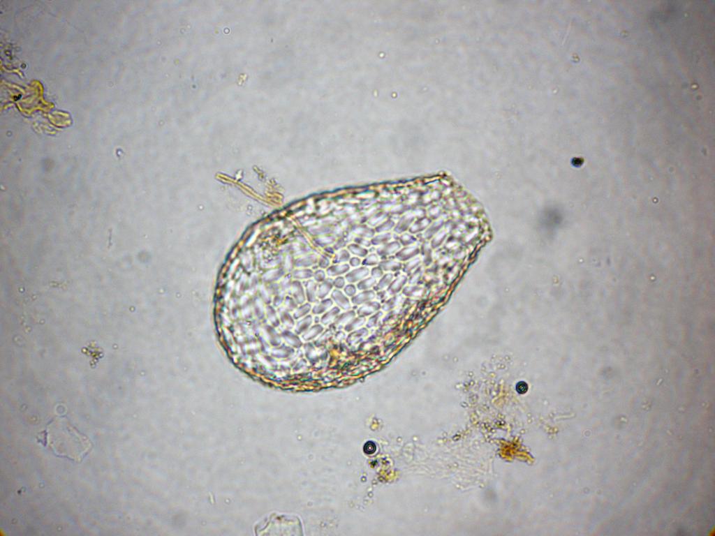 4. 5. Nebela sp.