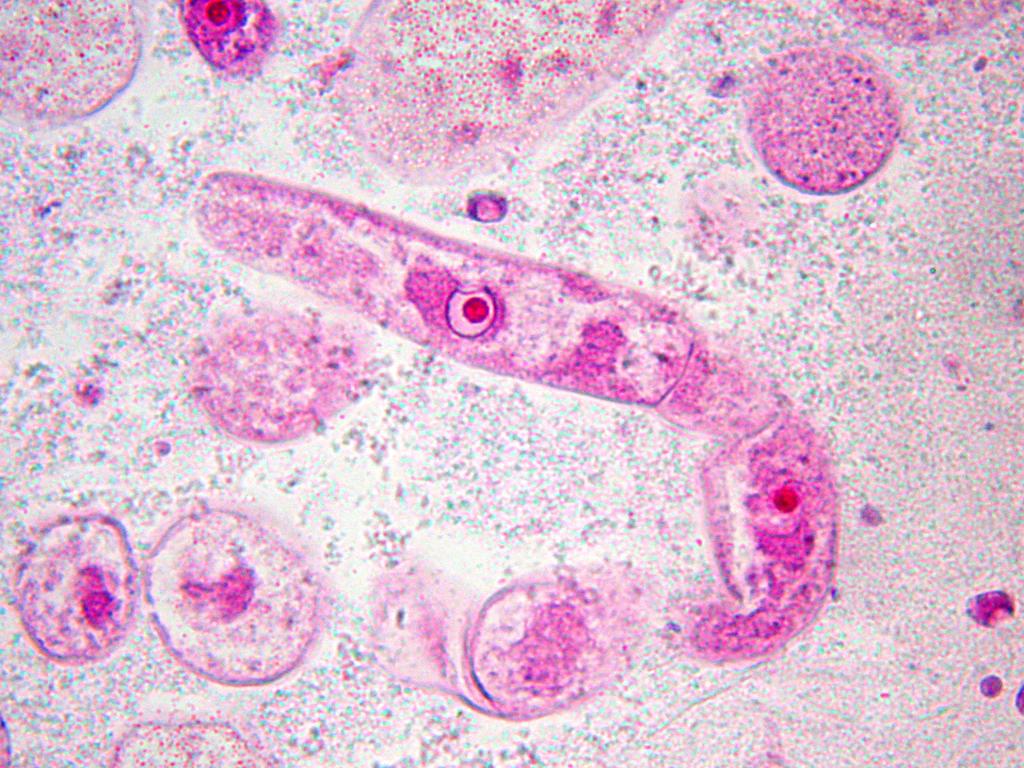 6. 1. Gregarina polymorpha Kmen: