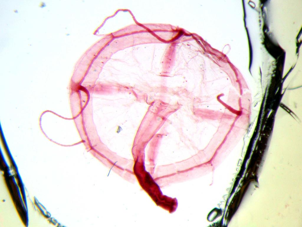 Třída: Hydrozoa