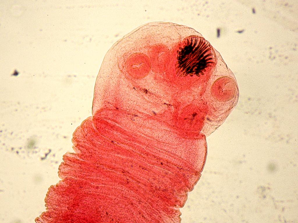 Podkmen: Neodermata