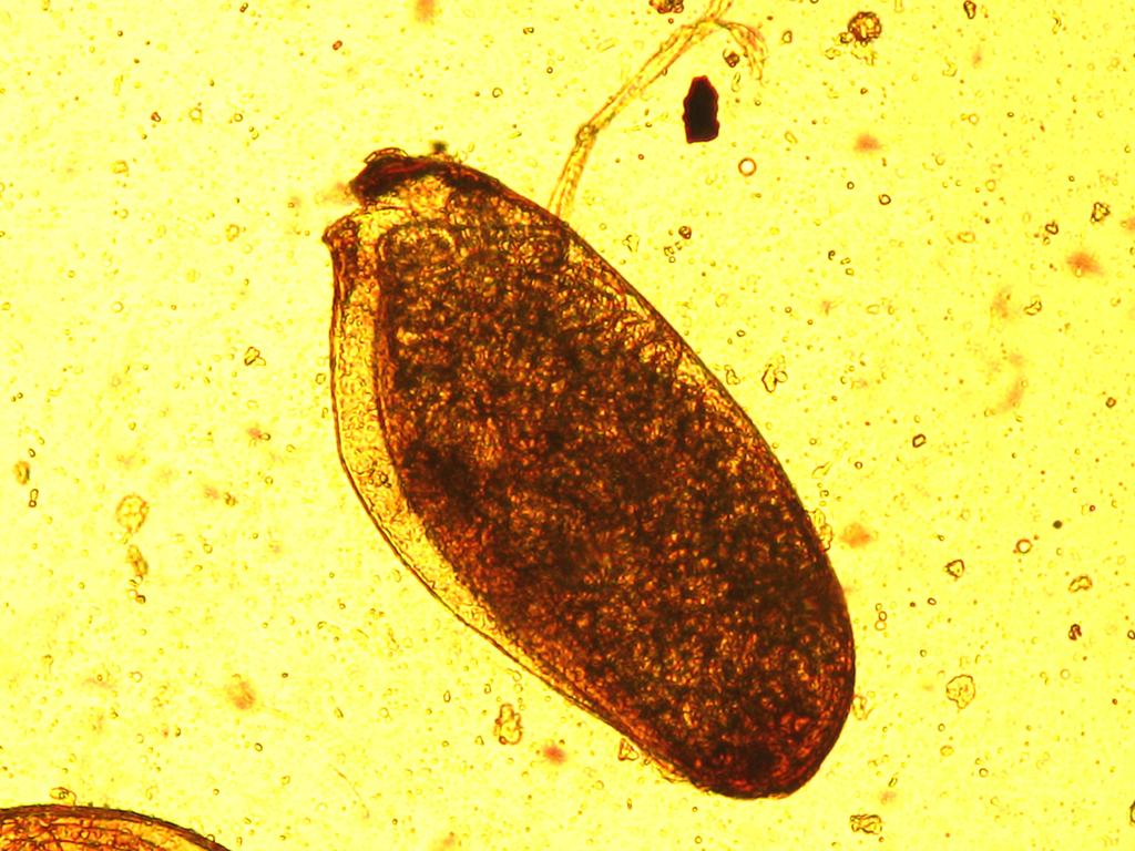 NEMATODA Třída: Phasmida