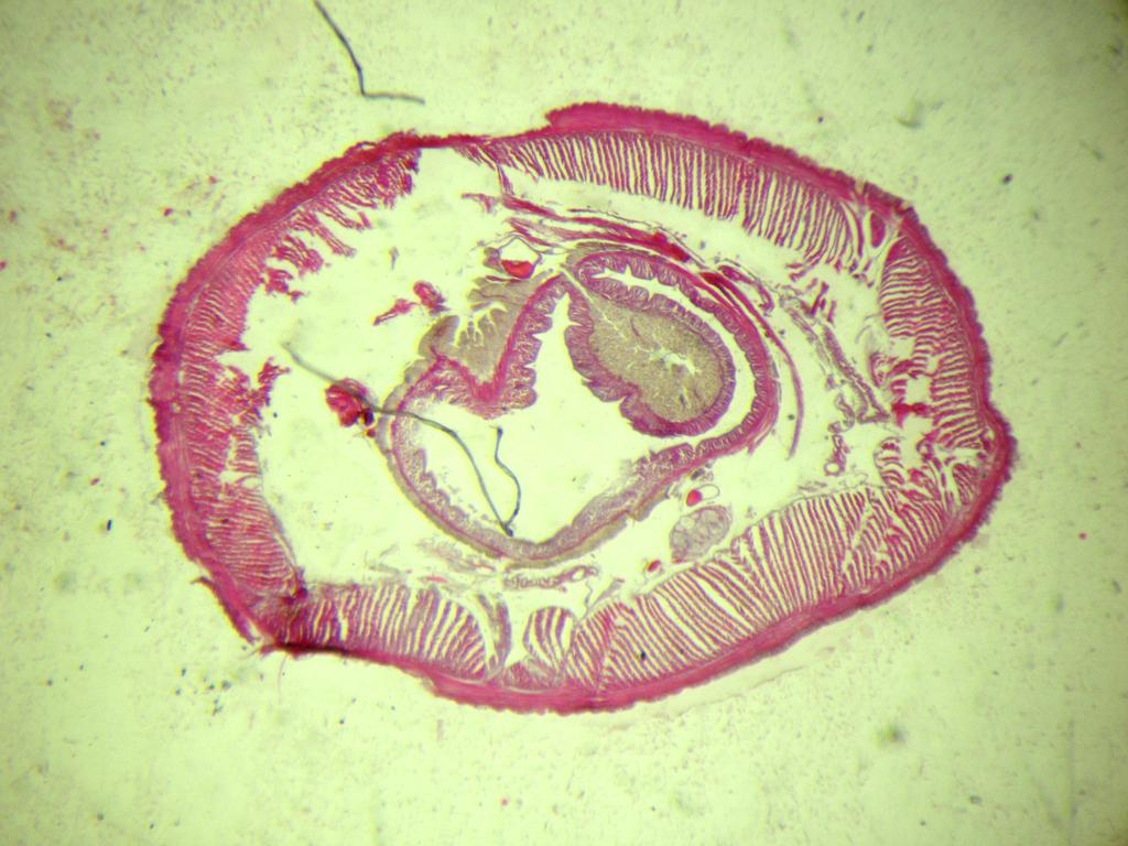 15. 1. Lumbricus terrestris (příčný řez) Kmen: ANNELIDA Třída: Clitellata Podtř.