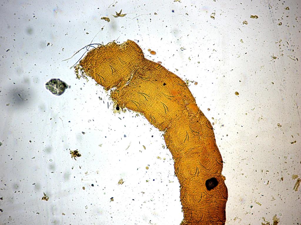 15. 4. Tubifex sp.