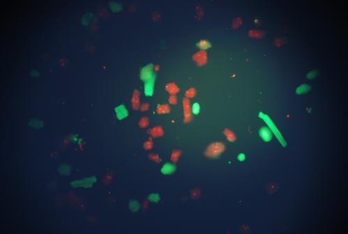 Výsledek č.: 2 Zdrojem je opět RGB obraz buněk z fluorescenčního mikroskopu se dvěma druhy buněk a to červené a zelené.