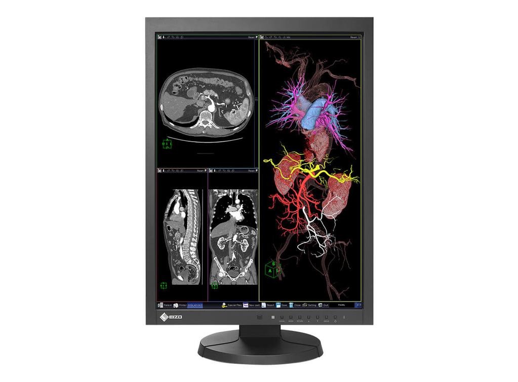 MX215 Vaše výhody Monitor EIZO MX215 disponuje křivkami tónování přednastavenými z výroby a zobrazuje odstíny šedé radiologických snímků objektivně.