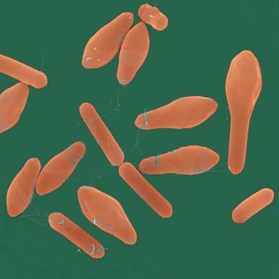 ROZDĚLENÍ JEDŮ 1. Mikrobiální toxiny proteiny Clostridium botulinum LD50 : 3.