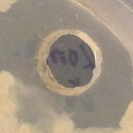 1:20 Micrococcus luteus Velikost