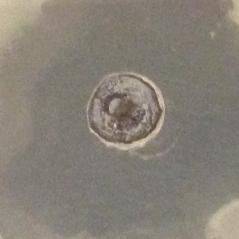 0 U kvasinky Candida glabrata