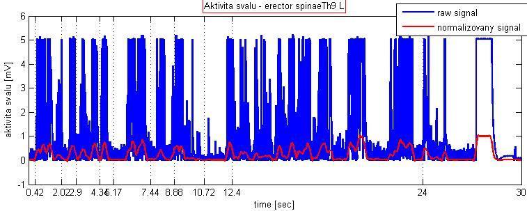 Obrázek E.3: Erector spinae levý, hrudní část: normalizovaný signál (červený) a nativní rektifikovaný nenormalizovaný signál (modrý) získaného pro konkrétní sval při jednom měření. Obrázek E.