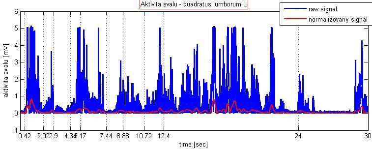 Obrázek E.9: Quadratus lumborum levý: normalizovaný signál (červený) a nativní rektifikovaný nenormalizovaný signál (modrý) získaného pro konkrétní sval při jednom měření. Obrázek E.