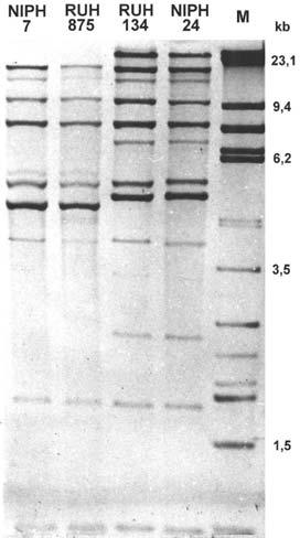 Podle EcoRI ribotypů jich bylo 77 (75 %) identifikováno jako A. baumannii, ostatní jako další DNA skupiny komplexu ACB. A. baumannii zahrnoval všechny multirezistentní a epidemické kmeny.