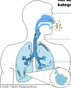 Pronikání v dýchacím ústrojí Kam se dostanou Nos / Sliznice Dýchací trubice (Trachea)