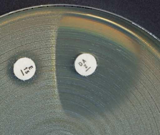 Disky erytromycinu a klindamycinu se umístí ve vzdálenosti 12-20 mm mezi okraji