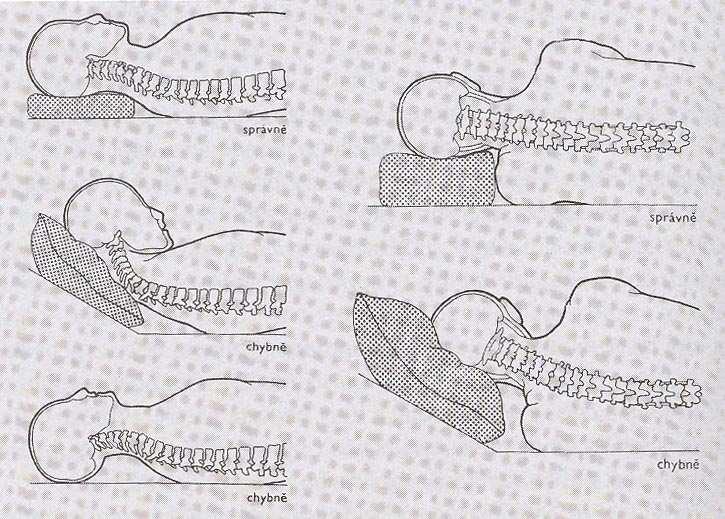 Příloha VIII: Správné provádění pohybových stereotypů 1. Leh na lůžku: poloha na břiše je nevhodná, při poloze na zádech či na boku je velmi významné podložení hlavy (obr. 23).