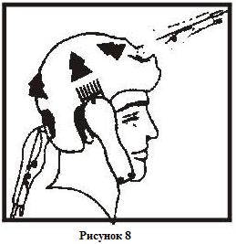 Nejprve použíjte nejdelší nástavec-hřeben (12 mm), stříhejte od spodní části krku do horní části hlavy.