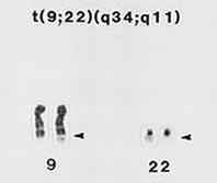 hpms1 hpms2 protein kódovaný tímto genem tvoří heterodimery s proteinem kódovaným genem hmlh1, byl detekován v mutované formě v některých HNPCC HNPCC, typ 4, Turcottův syndrom provázený výskytem