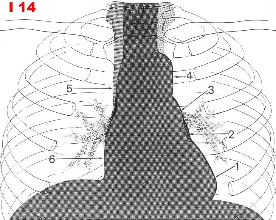 Rentgen srdce / X-ray of the heart