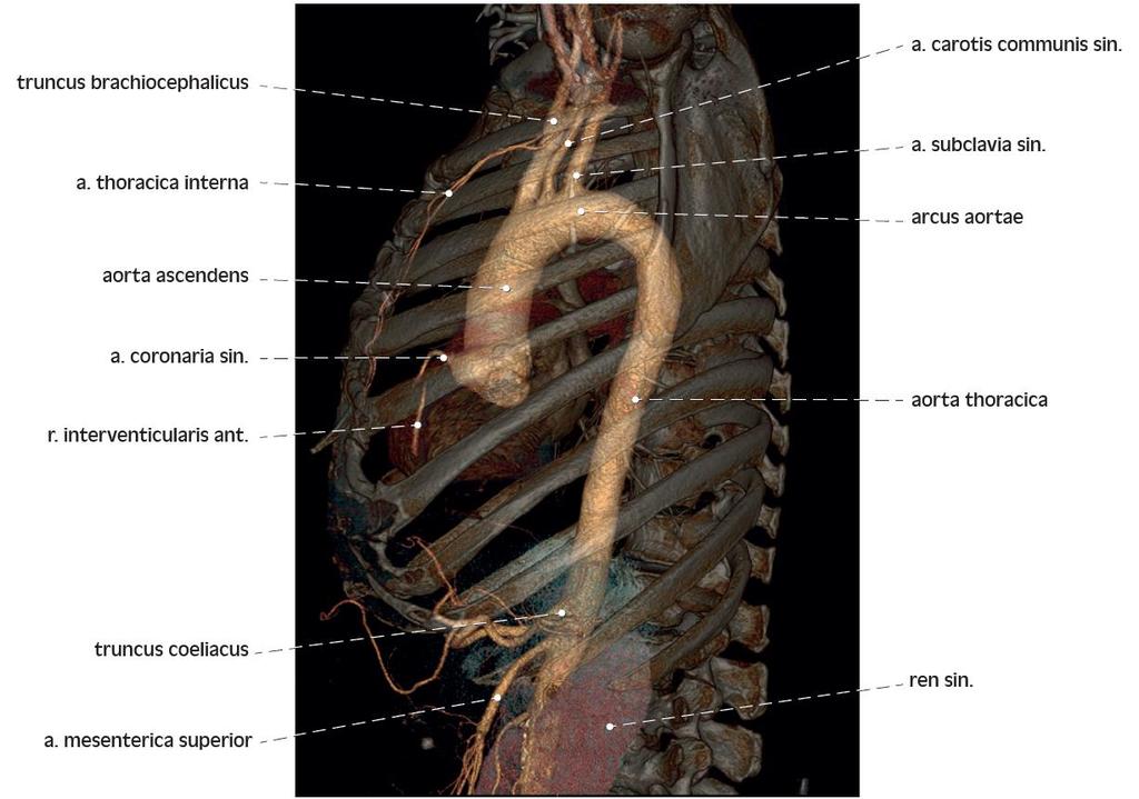 3D rekonstrukce CT angiografie srdečnice 3D