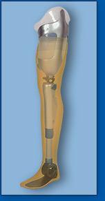 Obrázek 32: Exoskeletová konstrukce (Fitzlaff a Heim, 2002) Obrázek 33: Endoskeletová konstrukce (www. ortotika-protetika.cz) 7.