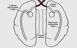 převodní jádro) Tr. geniculocalcarinus (radiatio optica) do zrakové kůry Tr.