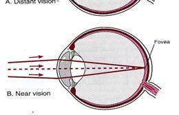 Kontrakce hladké svaloviny (parasympatikus) největší zakřiv pro vidění nablízko (akomodace)