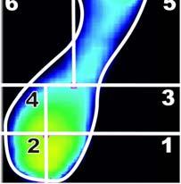 Specifické oblasti nohy (upraveno dle Anonymous, 1999) Svoji pozornost jsme pro komplexnost hodnocení plosky nohy zaměřili na několik dalších parametrů.