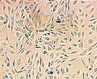 4 Wound healing assay Do souvislé vrstvy endoteliálních buněk byly vytvořeny rýhy a byly