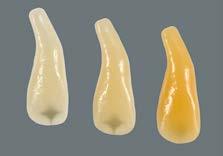Individualizující vrstvení na příkladu korunky pro jednotlivý zub CERVICAL v oblasti těla se hmota CERVICAL nanese pro dokončení tvaru korunky.