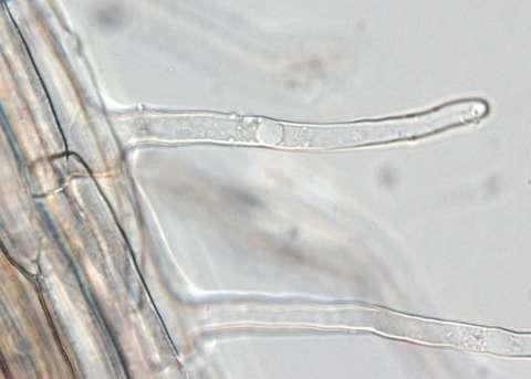 Root hair