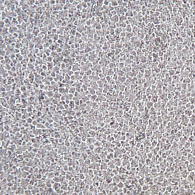 9.3 Struktura pokožky Cissus rhomboidea Vahl. Pokožkové buňky žumenu jsou nepravidelné a laločnaté. Trichomy se vyskytují ojediněle na svrchní straně listu, na spodní straně listu se vyskytují hojně.