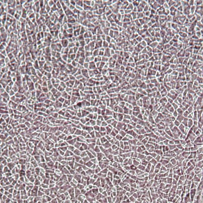 9.8 Struktura pokožky Ficus benjamina L. Pokožkové buňky fíkusu, jsou velmi malé tří až čtyřhranné. Jsou špatně viditelné nejspíš kvůli silné kutikule.