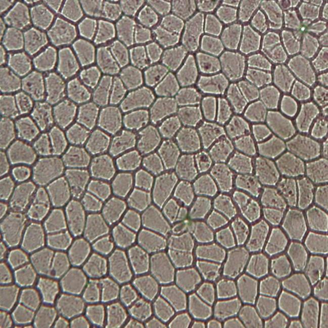 9.14 Struktura pokožky Peperomia obtusifolia A. Dietr Pepřinec má pokožkové buňky nepravidelné, čtyř až osmihranné a jejich okraje jsou rovné až zaoblené.