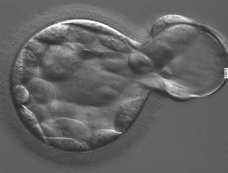 9: Asistovaný hatching  10:
