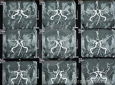 Některé orgány jako nervy či mozková tkáň bylo možné neinvazivně zobrazovat až právě pomocí MRI. Rozlišení přesahuje možnosti rentgenu či CT.