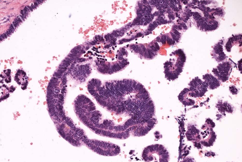4 Detail histologického preparátu, papily kryté basofilním epitelem zvětšeno