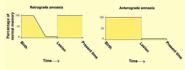 Poruchy paměti Retrográdní amnézie na události před