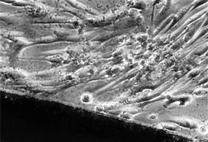 Cytotoxicita nosiče Kontaktní cytotoxicita vložení