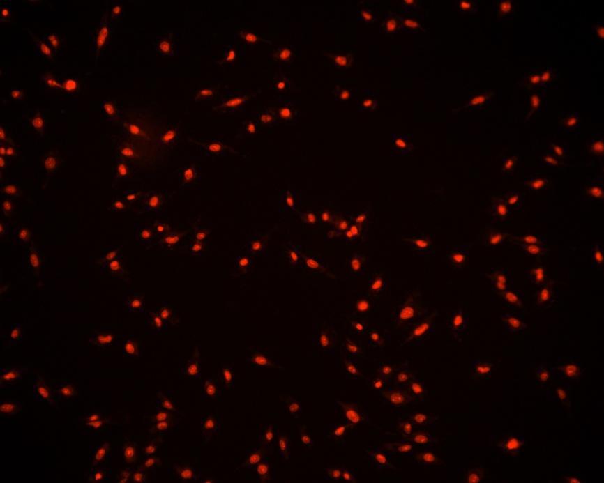 Fluorescenční mikroskopie Barvení buněčných