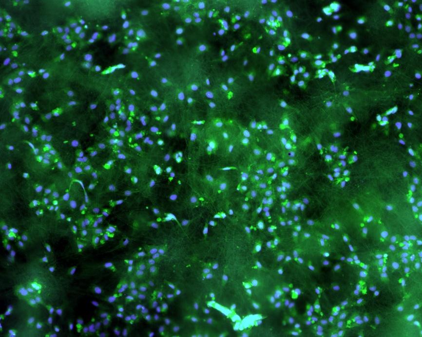 fluorescein Specifické barvení fokální adheze