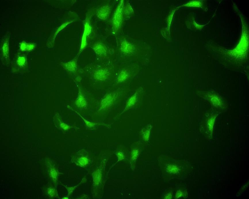 Fluorescenční mikroskopie Kvantifikace počet buněk