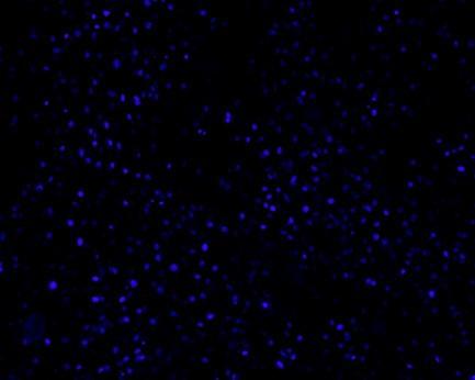 Fluorescenční