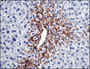 Imunohistochemie (IHC) Princip: vazba specifické