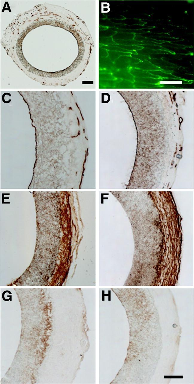 A through G, Endothelialization, SMCs, and inflammatory cells in hirudin-peg-plla grafts.