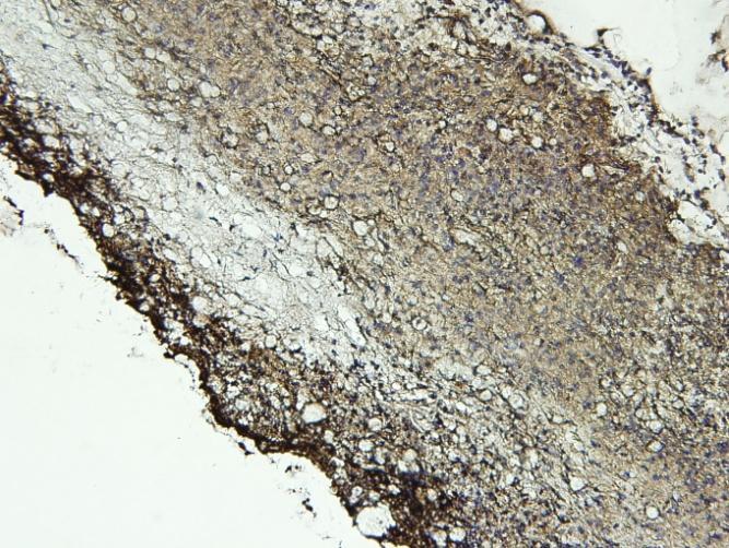 CD 206